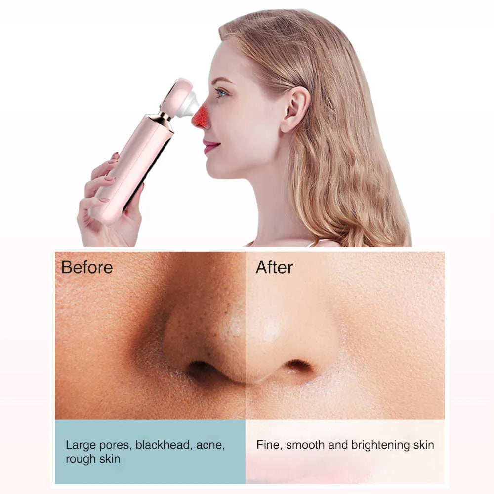 Tijarat™  Blackhead Suction Machine